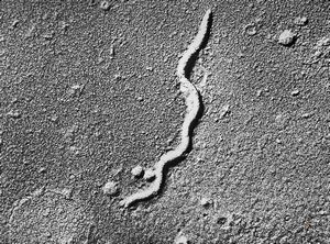 oral saprophytic bacterium oral saprophytic bacterium